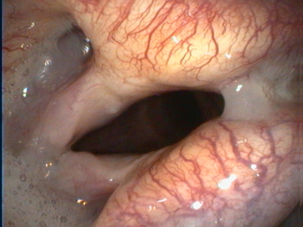 Endoskopie Copyright Jürgen Haacker 2018